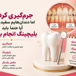 آیا جرم گیری دندان را سفید می کند
