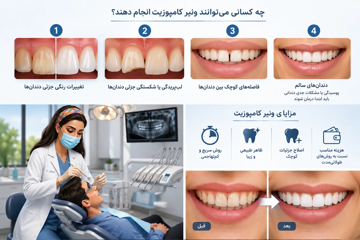 چه کسانی می‌توانند ونیر کامپوزیت انجام دهند؟