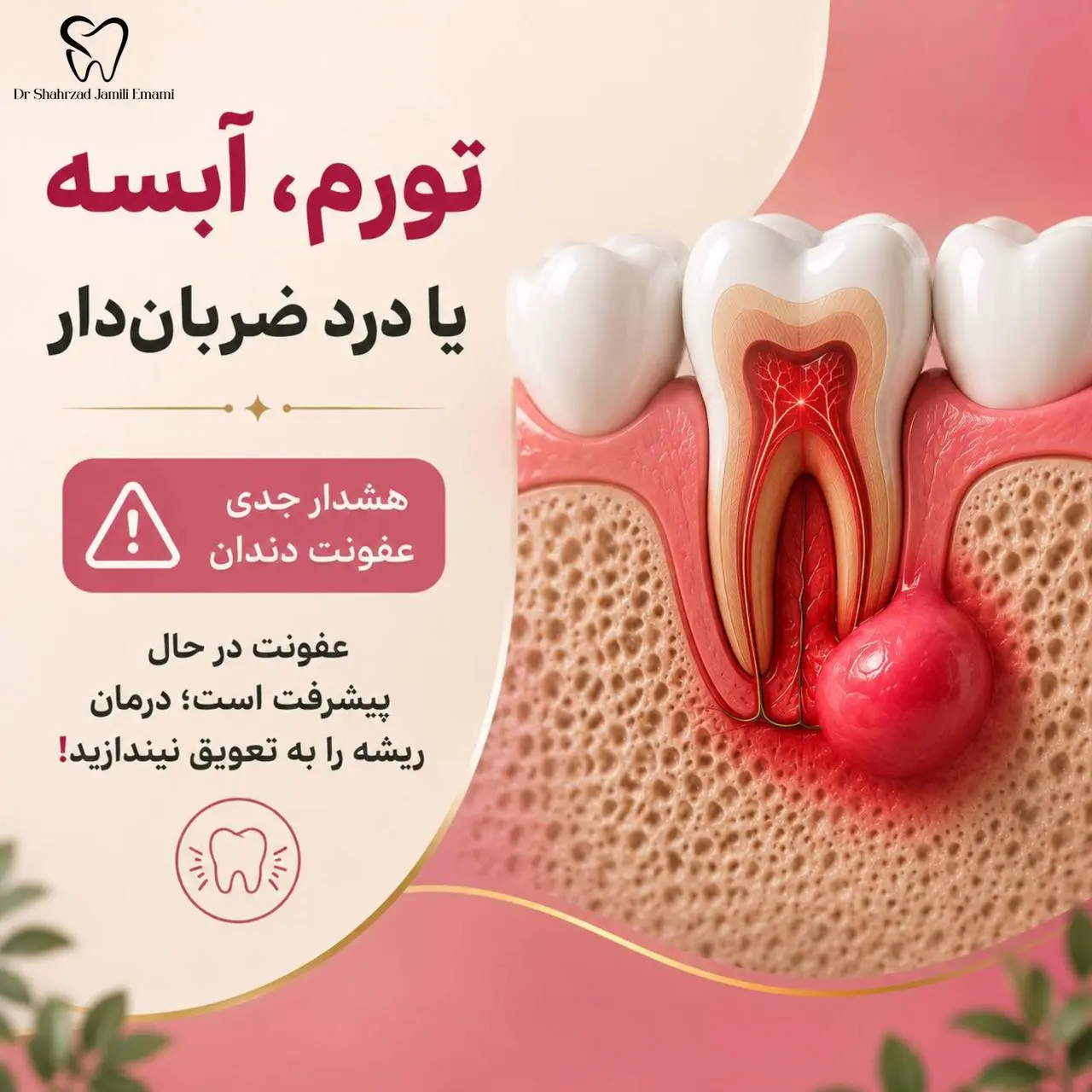 درد ضربان‌دار، آبسه و تورم لثه