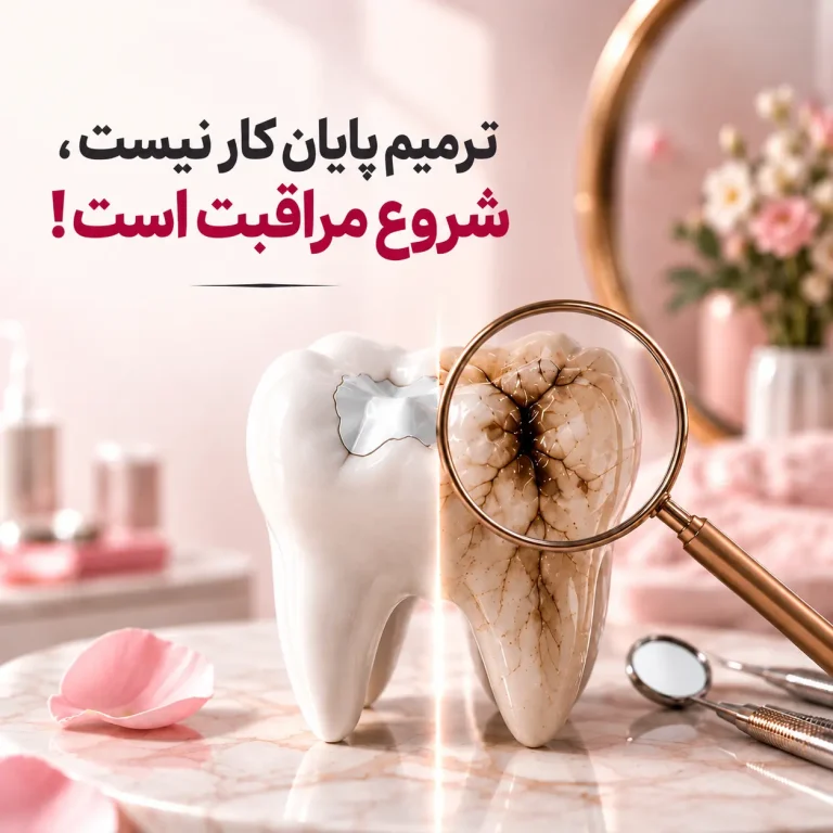 دندانی که یک‌بار پر شده، برای همیشه سالم می‌ماند؟