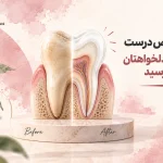 انتخاب درمان زیبایی دندان