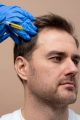 man-getting-prp-injection-alopecia-min
